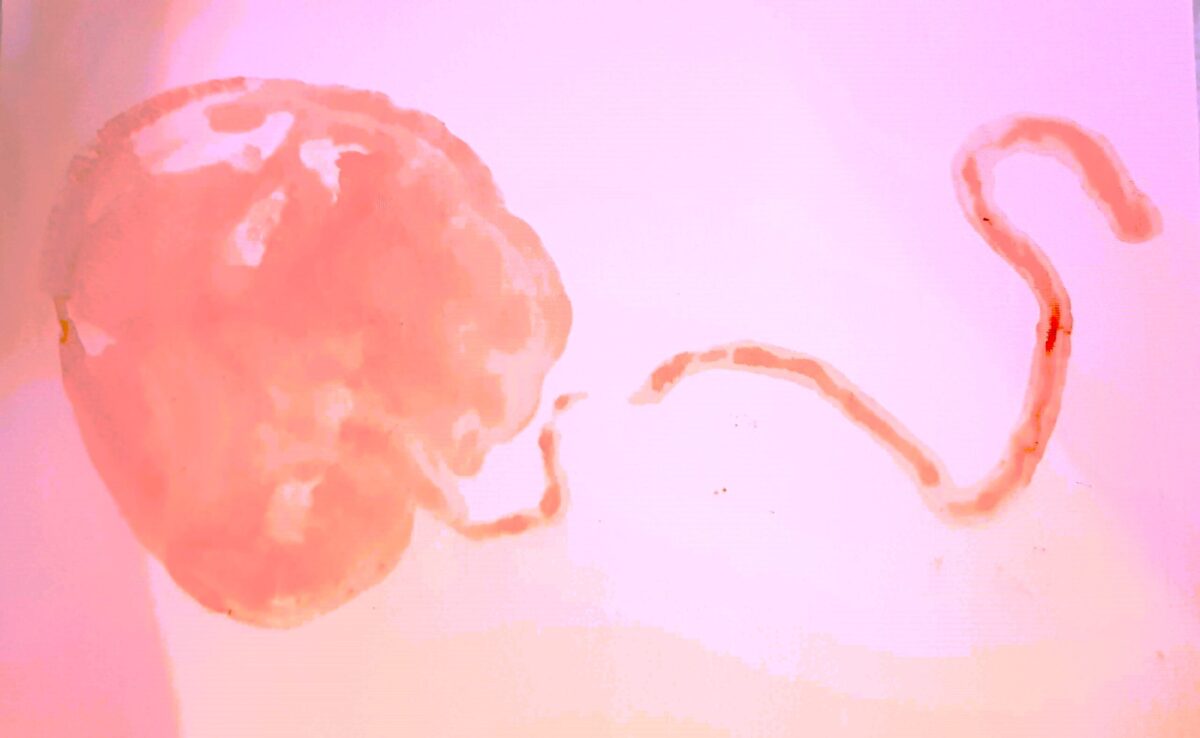 Print of a placenta